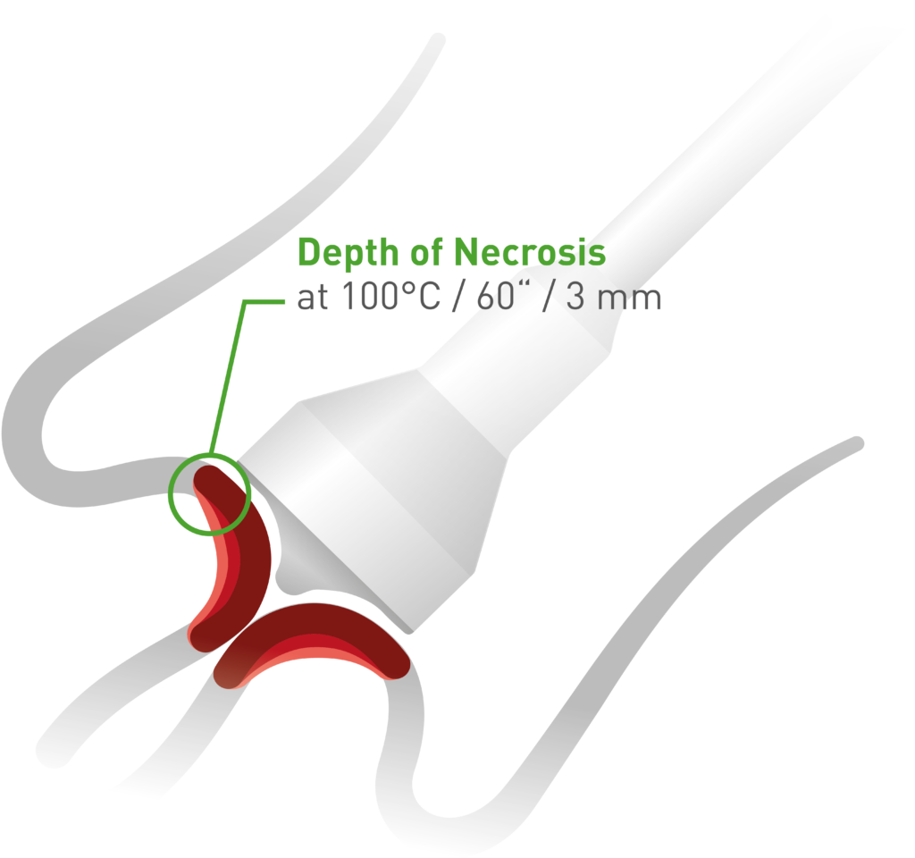 WISAP GYN Diagramm